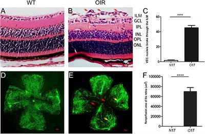 Expression of the neuroprotective factors BDNF, CNTF, and FGF-2 in normal and oxygen induced retinopathy